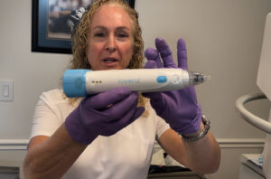 Cryoablation Staten Island