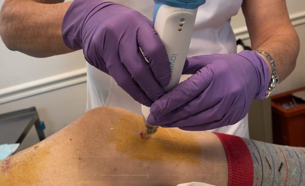 Treating Knee Pain